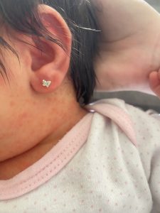 Colocación de pendientes a domicilio colocacion de pendientes 6